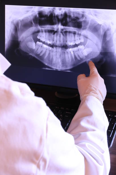 Best Emergency Dental Care for Broken or Chipped Teeth in Fruitdale, CA