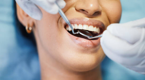 Best Emergency Denture Repair in Fruitdale, CA